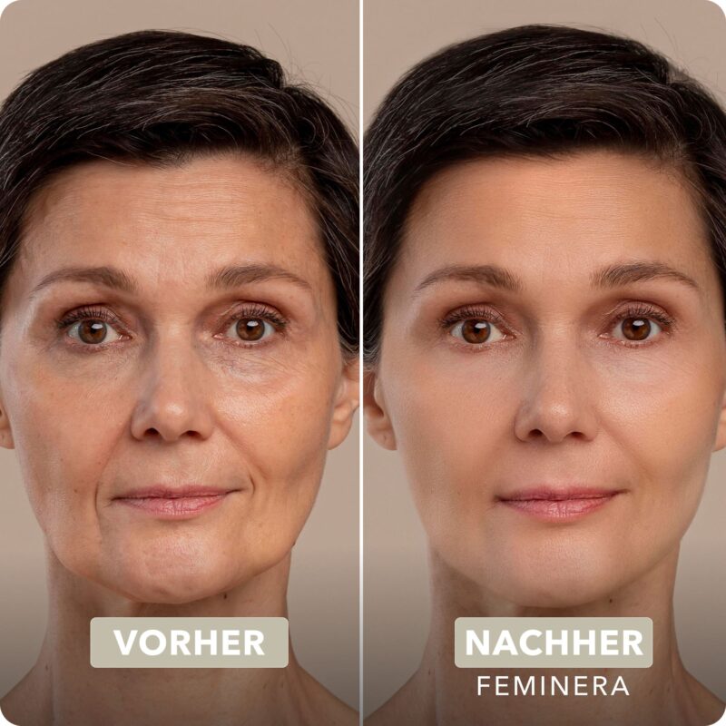 Vicuno Instant Lift Eye Serum with Immediate Effect - Image 7