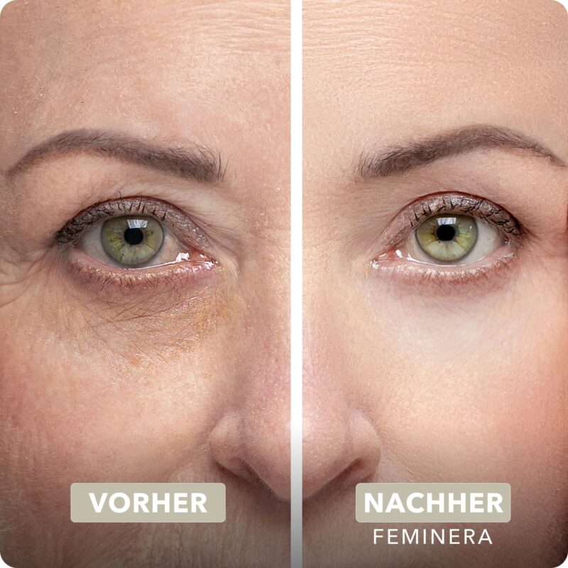 Vicuno Instant Lift Eye Serum with Immediate Effect - Image 8