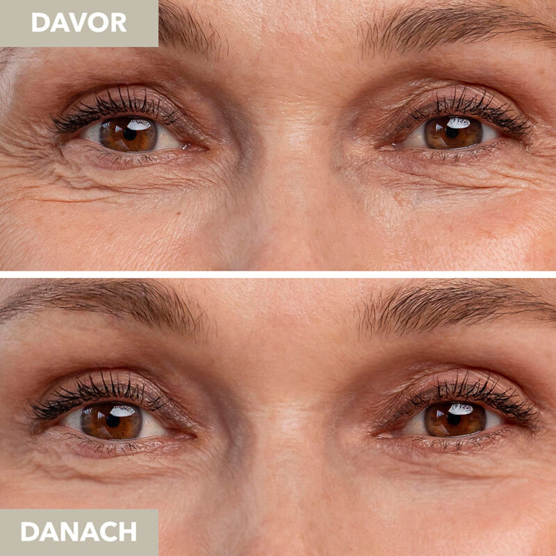 Vicuno Instant Lift Eye Serum with Immediate Effect - Image 3