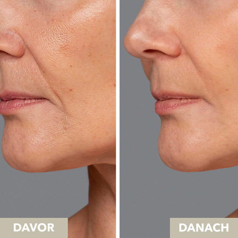 Vicuno Night Cream with Hyaluronic Acid & Ceramides - Image 4