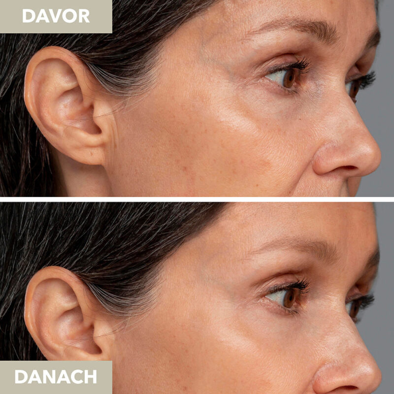 Vicuno Hyaluronic Day Cream - Image 5